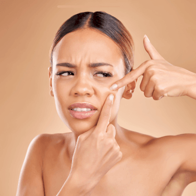 Komedon Nedir? Komedona Sebep Olan İçerikler Nelerdir?